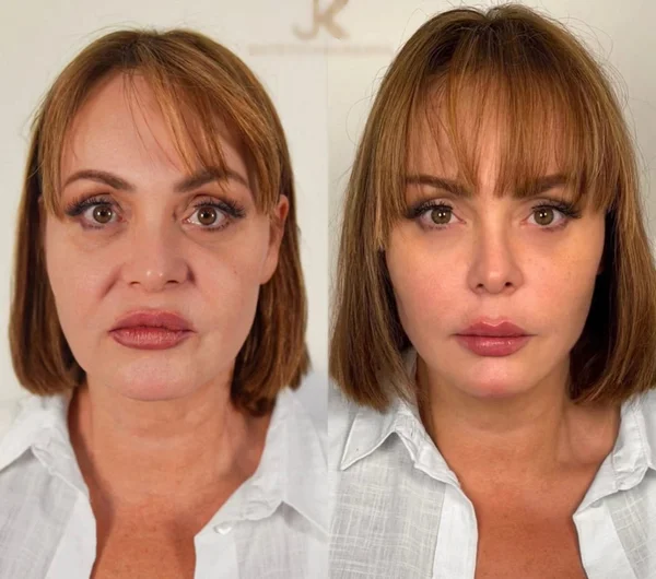 gaby-spanic-antes-e-depois.jpg